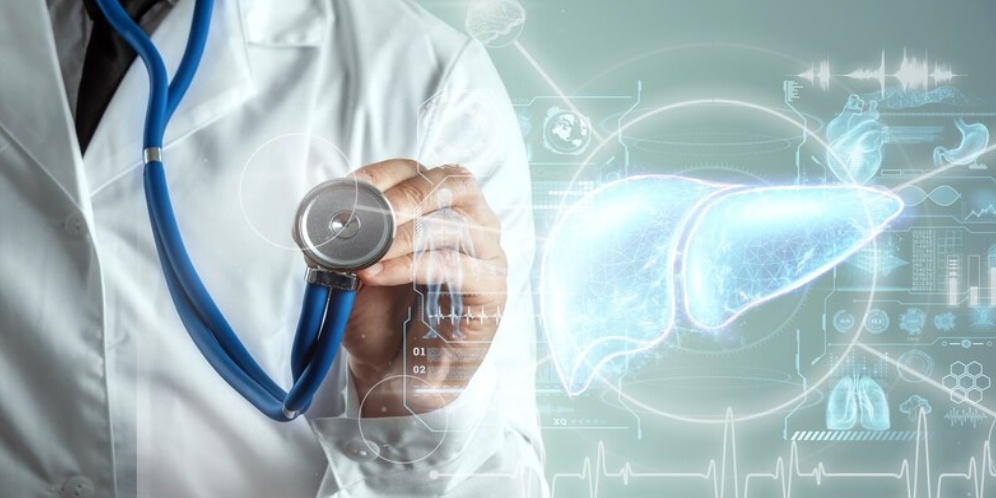 Image is not available